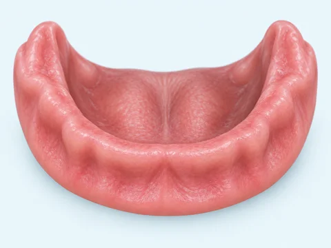Ilustração: Perdi todos ou quase todos os dentes